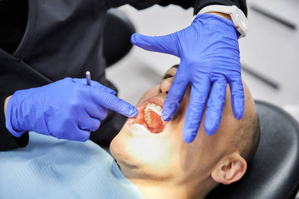 Best Broken Tooth Emergency  in Wetherington, OH