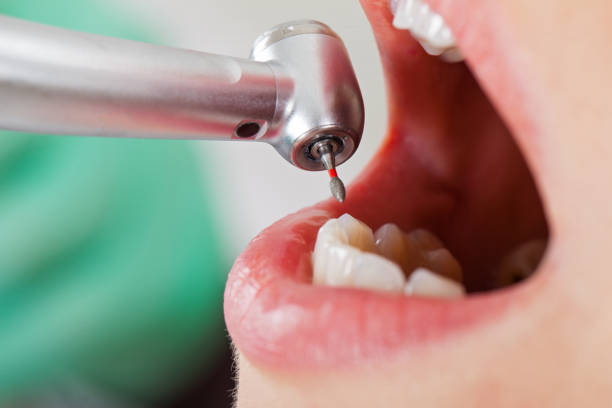 Best Dentist for Tooth Abscess  in Wetherington, OH